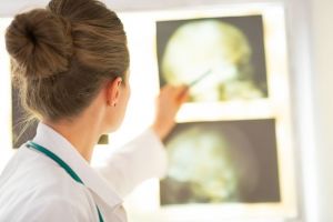 Αδιέξοδο στις συναντήσεις υπουργείου Υγείας – ιδιωτών γιατρών – Ένα βήμα πριν την επιστράτευση