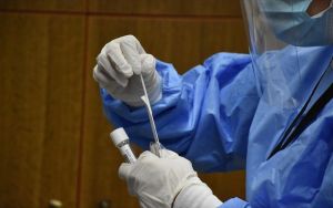 Στα 3.628 τα νέα κρούσματα και 22 θάνατοι – Στους 344 οι διασωληνωμένοι