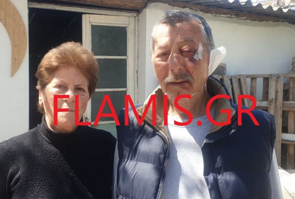 Λήστεψαν και βασάνισαν ζευγάρι στην Αιγιαλεία – Η γυναίκα αναγνώρισε δύο από τους δράστες