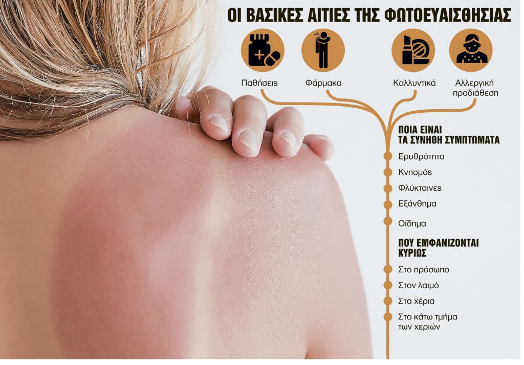 Τα φάρμακα που κάνουν το δέρμα… ευάλωτο στον ήλιο