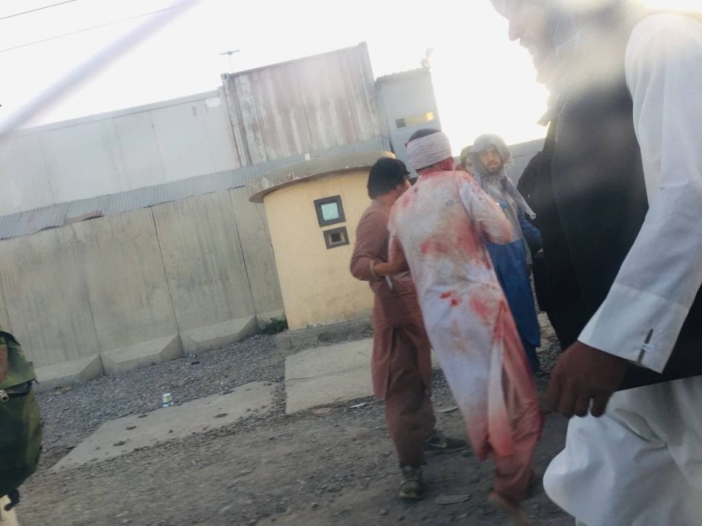 Σοκαριστικά βίντεο και φωτογραφίες μετά τις εκρήξεις στην Καμπούλ
