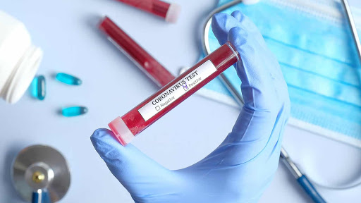 Κοροναϊός – Νέο τεστ αίματος αυτο-αντισωμάτων μπορεί να προβλέψει την πιθανότητα σοβαρής νόσησης