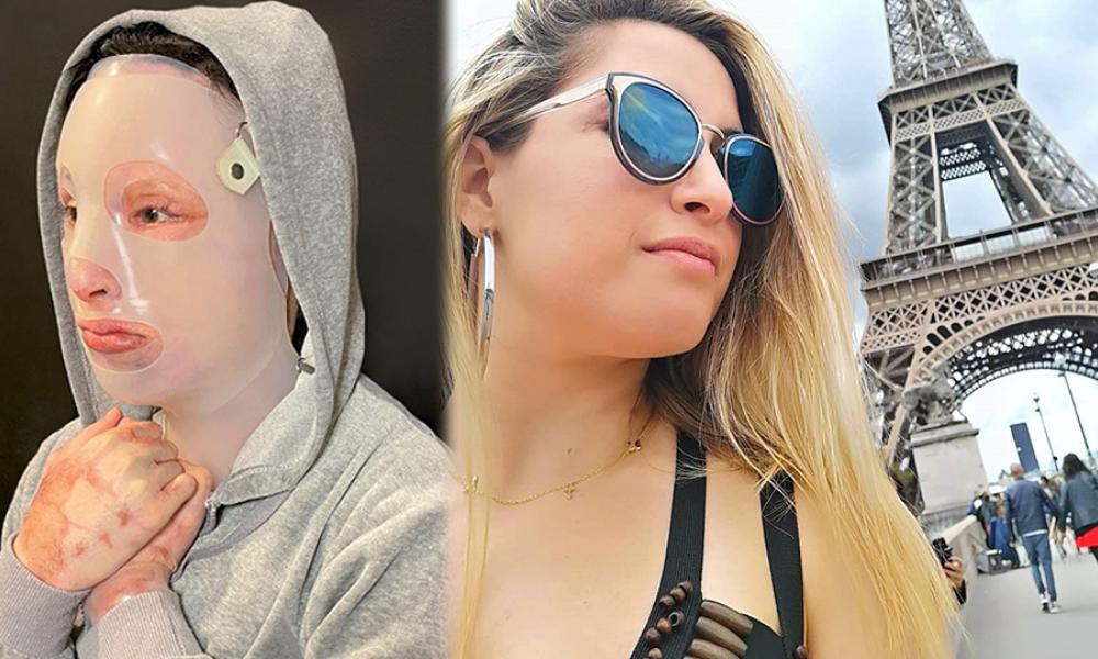 Επίθεση με βιτριόλι – Η Ιωάννα θέλει να παραστεί στο δικαστήριο και να αντιμετωπίσει την κατηγορούμενη