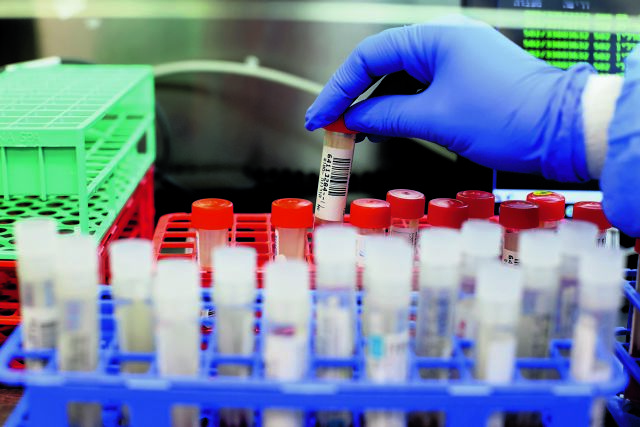 Η Ελλάδα παρέλαβε 2.000 δόσεις μονοκλωνικών της Regeneron