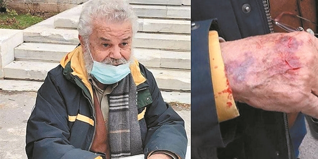 Λίγο αίμα στο πουκάμισο