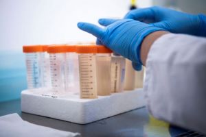 Σαρηγιάννης – Εως 50-60.000 κρούσματα τις επόμενες ημέρες