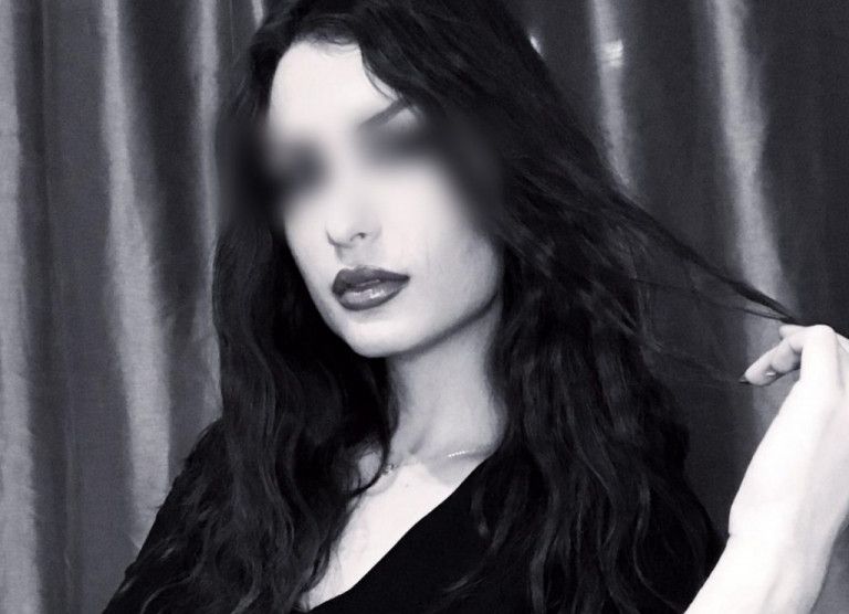 Σοκαριστικές φωτογραφίες με τους μώλωπες στο σώμα της 24χρονης | tanea.gr