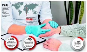 Εξαρση των συμπτωμάτων της ψωρίασης τον χειμώνα