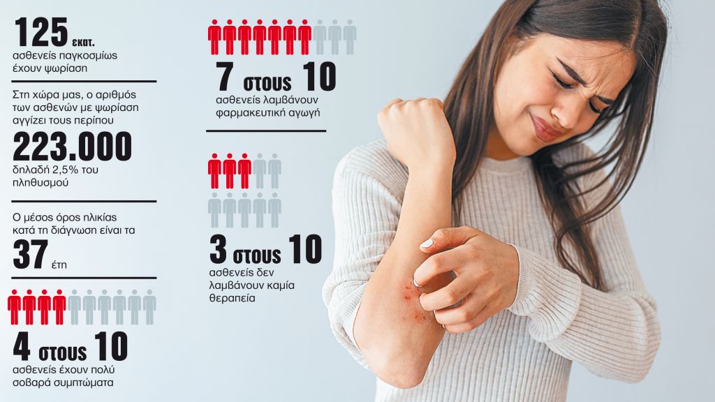 Πώς η διατροφή μπορεί να βοηθήσει ασθενείς με ψωρίαση