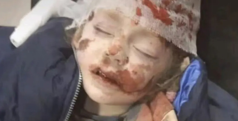 Ουκρανία: Νύχτα ντροπής για τους Ρώσους στην πόλη Σούμι – Βομβάρδισαν παιδιά και αμάχους