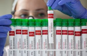 Κοροναϊός: 21.260 νέα κρούσματα και 49 θάνατοι