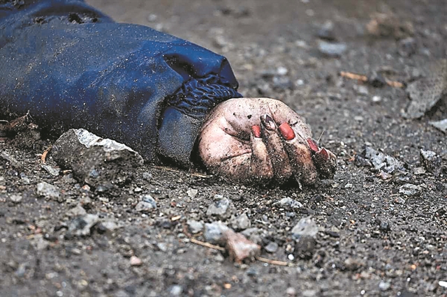 Op-Ed: The hands of human beings