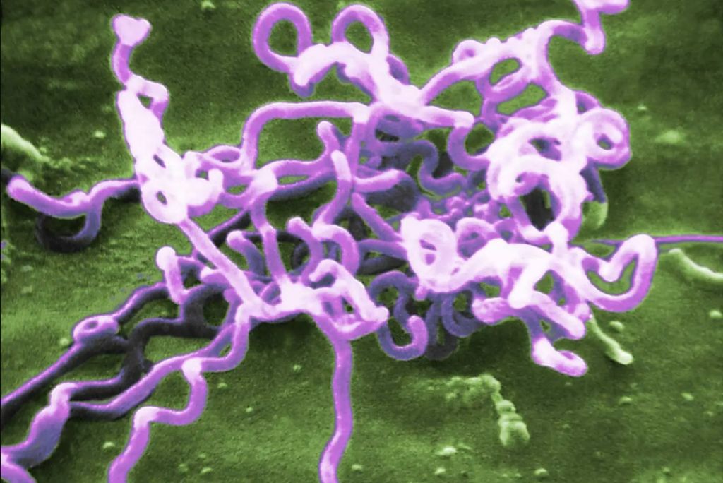 Σύφιλη: Η «ξεχασμένη» ασθένεια που όμως ήταν πάντα εδώ