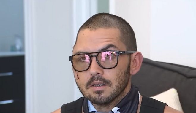 Άνδρας επέζησε από επίθεση αλιγάτορα – Αφαίρεσαν μέρος του κρανίου του