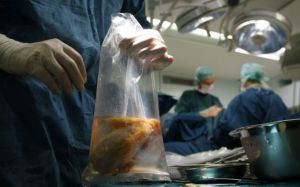 Κράτησαν τα όργανα ζωντανά έξι ώρες μετά τον τελευταίο χτύπο της καρδιάς!