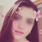 Καλαμάτα: Σοκάρει η περιγραφή της 34χρονης που δέχτηκε επίθεση από αγέλη σκύλων