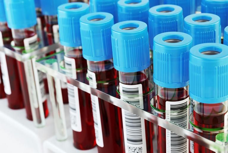 Κοροναϊός: Ερχεται το πρώτο τεστ αίματος που θα προβλέπει ποιος κινδυνεύει με long Covid | tanea.gr