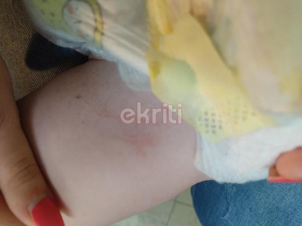 Σοκαριστικές εικόνες από την επίθεση του σκύλου σε μωρό που ήταν στην αγκαλιά της γιαγιάς του