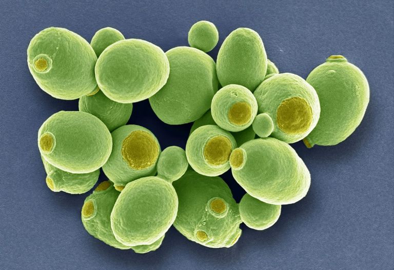 Καρκίνος: Μυστηριώδεις μύκητες βρέθηκαν να αναπτύσσονται μέσα στους όγκους | tanea.gr