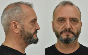 Σεπόλια: Πώς ο Μίχος ψάρευε «πελάτες»  – Τα 51 προφίλ σε τσατ και τα 29 μηνύματα στους επίδοξους βιαστές