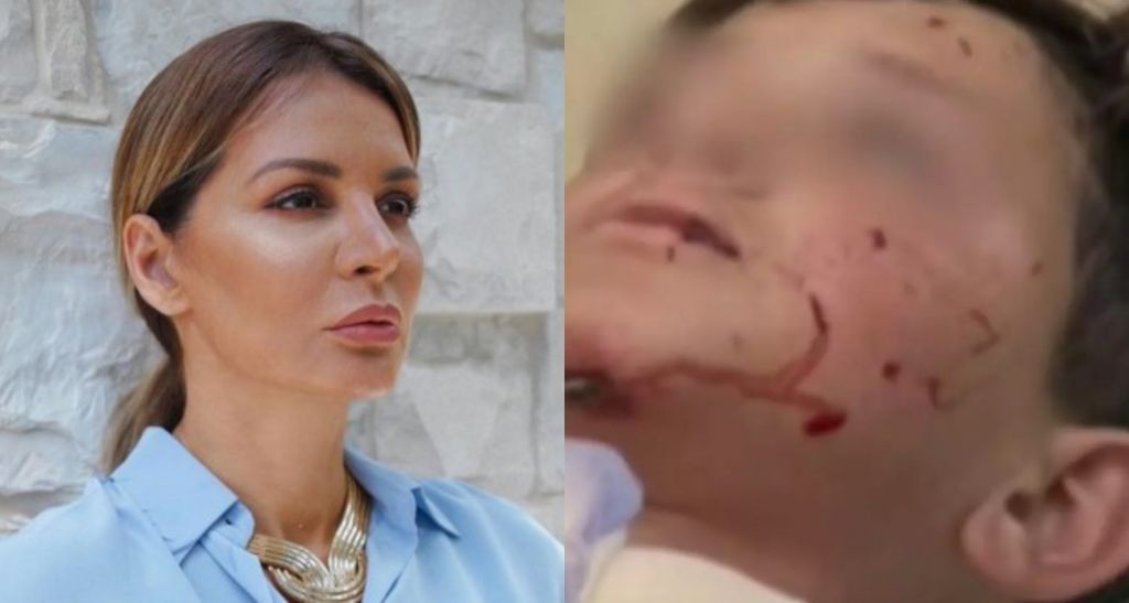 Ανιψιός της Μαρίας Καλάβρια το παιδί που δέχθηκε επίθεση από σκύλο στο Λαγονήσι