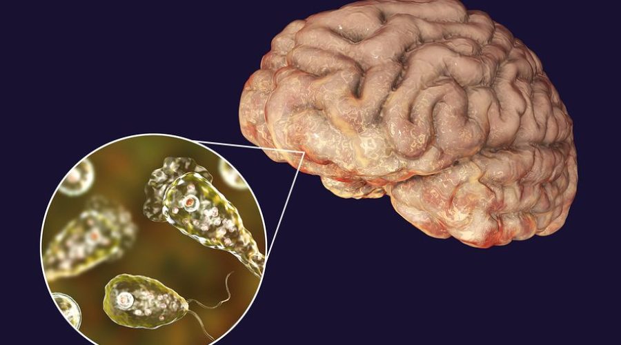 ΗΠΑ: Ανήλικος πέθανε από τη σπάνια ναιγλερίαση