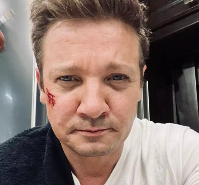 Τζέρεμι Ρένερ: Η κατάσταση της υγείας του μετά το ατύχημα με εκχιονιστικό