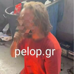 Πάτρα: Στην Ασφάλεια ο 35χρονος Ρομά που του έβαλαν φωτιά ενώ έλεγε τα κάλαντα