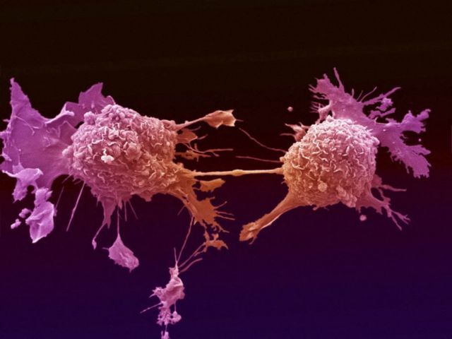Πώς μπορούμε να μειώσουμε τον κίνδυνο εμφάνισης καρκίνου;