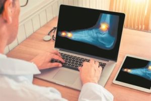 Ουρική αρθρίτιδα: Παράγοντας κινδύνου για έμφραγμα και εγκεφαλικό