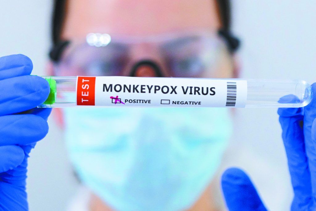 Ευλογιά των πιθήκων: Προειδοποίηση για αύξηση των κρουσμάτων την άνοιξη και το καλοκαίρι