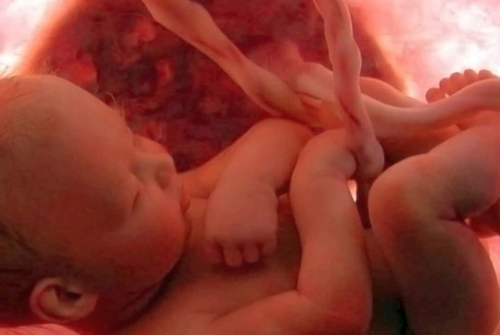 Κοροναϊός: Σοβαρές εγκεφαλικές  βλάβες σε βρέφη κατά την εγκυμοσύνη