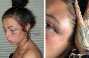 Ενδοοικογενειακή βία: Ο ταξιτζής που έσωσε μητέρα δύο παιδιών από τον κακοποιητικό πρώην της