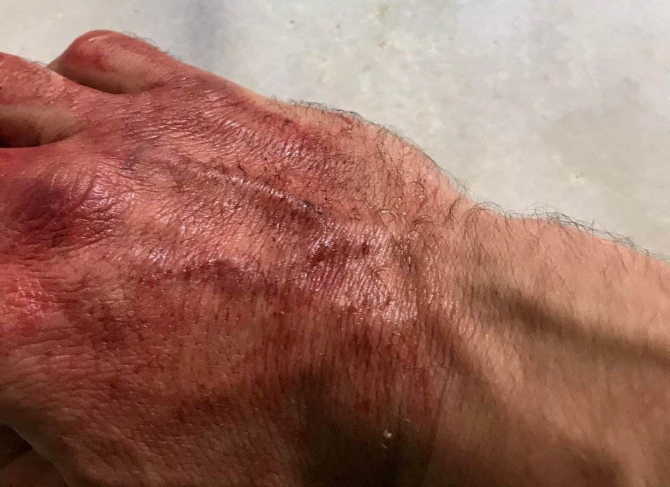 Χρυσαυγίτες επιτέθηκαν σε μέλος του ΣΥΡΙΖΑ στο Ζεφύρι