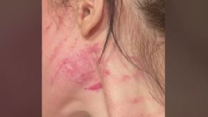 Ενδοοικογενειακή βία: Ζήτησε από το σύντροφό της να χωρίσουν και την έσπασε στο ξύλο