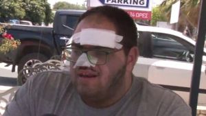 Γεωργιάδης: Παρέμβαση για την καταγγελία μάγειρα πως κάηκε με λάδι και τον έβαλαν σε ψυγείο κρεάτων