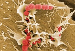 Στρεπτόκοκκος – Παγώνη: Σημαντικό να ελεγχθούν τα συμπτώματα τα πρώτα εικοσιτετράωρα