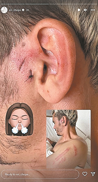 ΜΙΚΡΟ ΑΘΛΗΤΙΚΟΣ