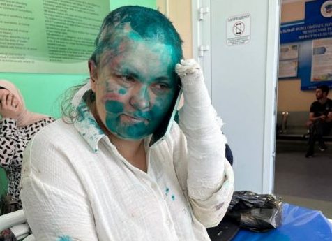 Άγρια επίθεση σε δημοσιογράφο – Την κούρεψαν και της έσπασαν τα χέρια