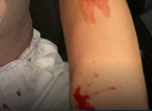 Σάλος στον Βόλο με τον διεθνή αθλητή που ξυλοκόπησε την πρώην σύζυγό του – Δεν εμφανίστηκε στο δικαστήριο