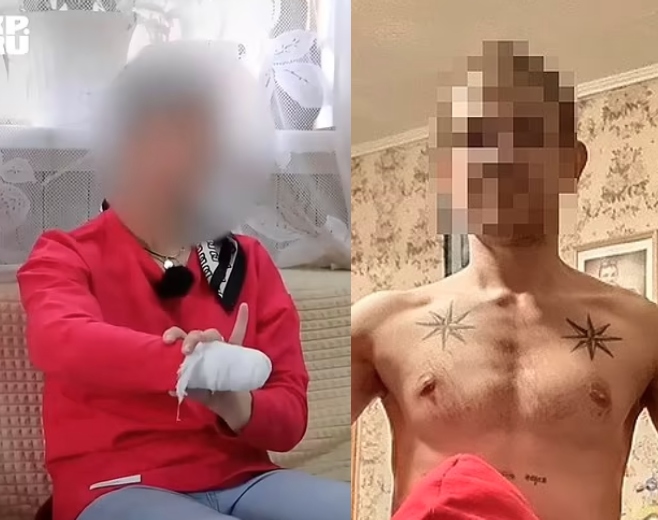 Ρωσία: Έκοψε το χέρι της γυναίκας του με μαχαίρι μπροστά στα μάτια του 5χρονου παιδιού της | tanea.gr