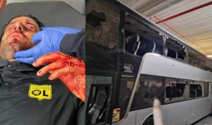 Εικόνες χάους από την Μασσαλία: «Διέλυσαν» πούλμαν με οπαδούς της Λιόν – Αιμόφυρτος ο προπονητής