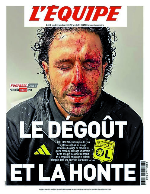 Το γαλλικό ποδόσφαιρο αιμορραγεί
