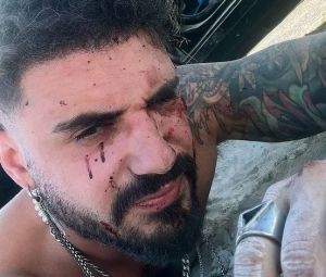 Ισραήλ: 28χρονος περιγράφει πώς επέζησε από το μουσικό φεστιβάλ – «Δέχτηκα δύο σφαίρες στην πλάτη»