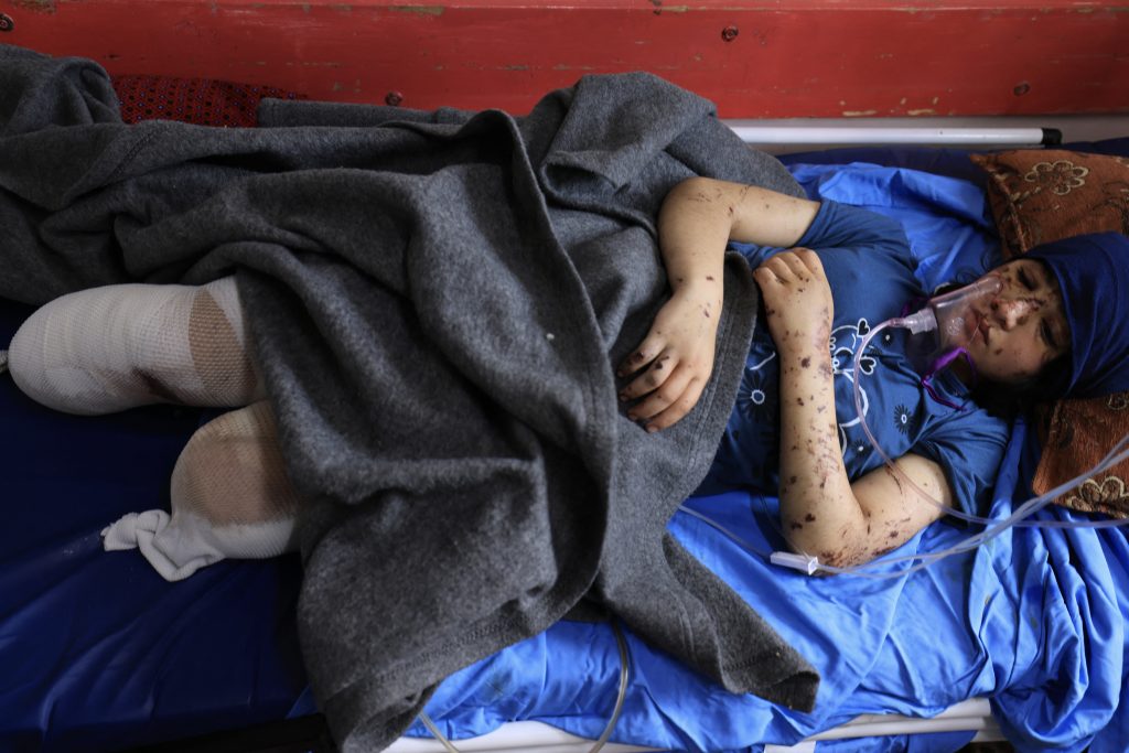 «Που είναι το πόδι μου»: Η φρίκη των ακρωτηριασμένων παιδιών στη Λωρίδα της Γάζας
