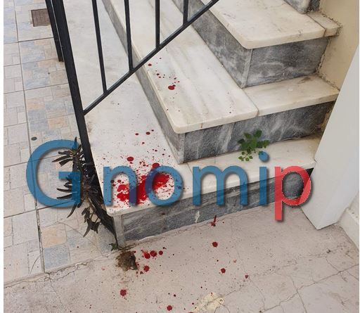 Πάτρα: Άγριος ξυλοδαρμός μαθητή έξω από ΕΠΑΛ – Του έσπασαν τη μύτη