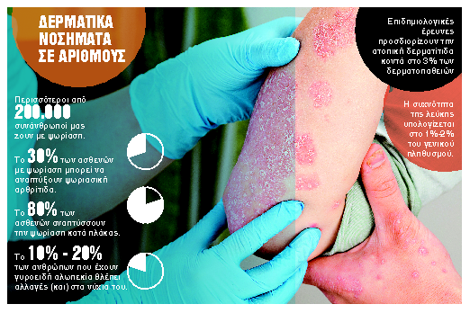 Τα αυτοάνοσα νοσήματα και οι νέες θεραπείες