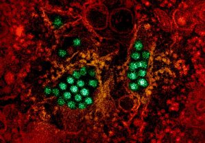 Η ασθένεια της κλιματικής αλλαγής απειλεί και την Ελλάδα – Σε συναγερμό οι αρχές