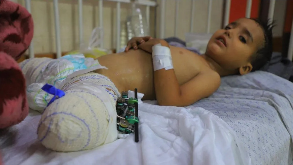 «Έκλαιγε και φώναζε συνεχώς τη νεκρή μαμά της» – Το δράμα των τραυματισμένων ορφανών στη Γάζα