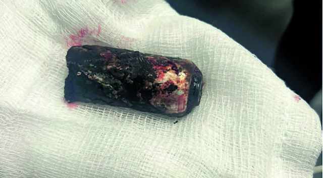 Αγώνας δρόμου για τη σύλληψη του χούλιγκαν